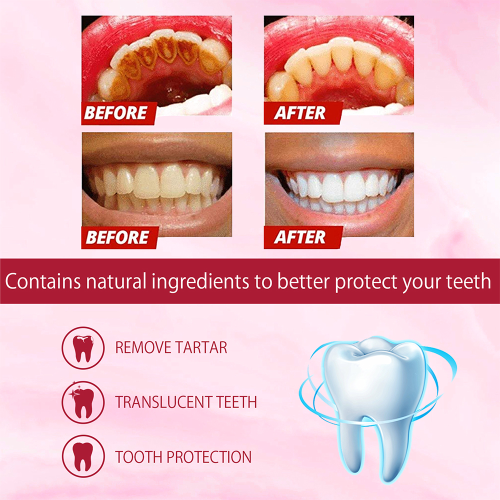 SP-4 Probiotic Whitening Tooth - Teeth Whitening Enzymes ulasan dan harga