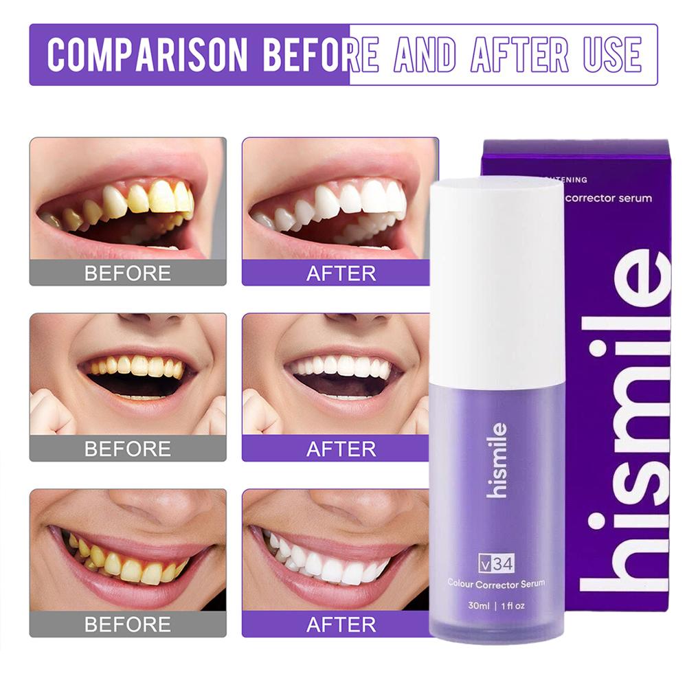 30ml Hismile V34 Purple Teeth  - Teeth Whitening Foam ulasan dan harga