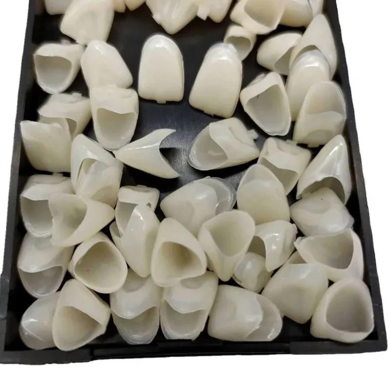 New Hotntal Veneers Porcelain  - Whitening Teeth Dentist ulasan dan harga