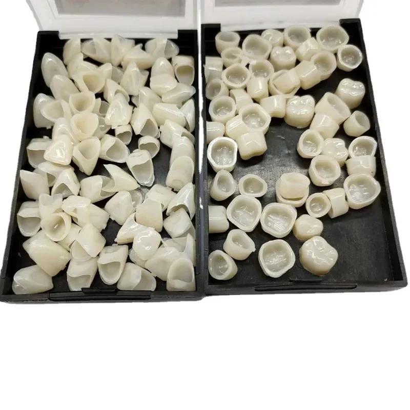 New Hotntal Veneers Porcelain  - Whitening Teeth Dentist ulasan dan harga