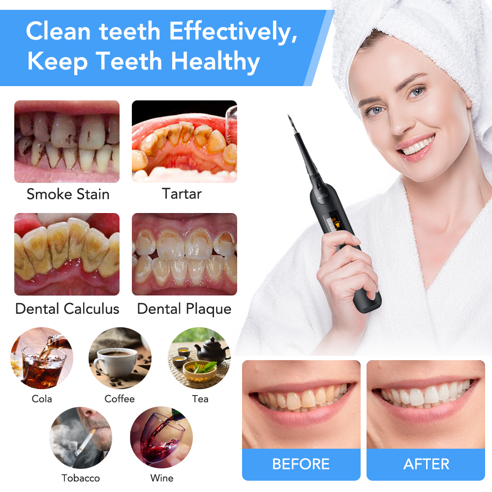 Teeth Tartar Remover Electric  - Teeth Whitening Home Kit ulasan dan harga