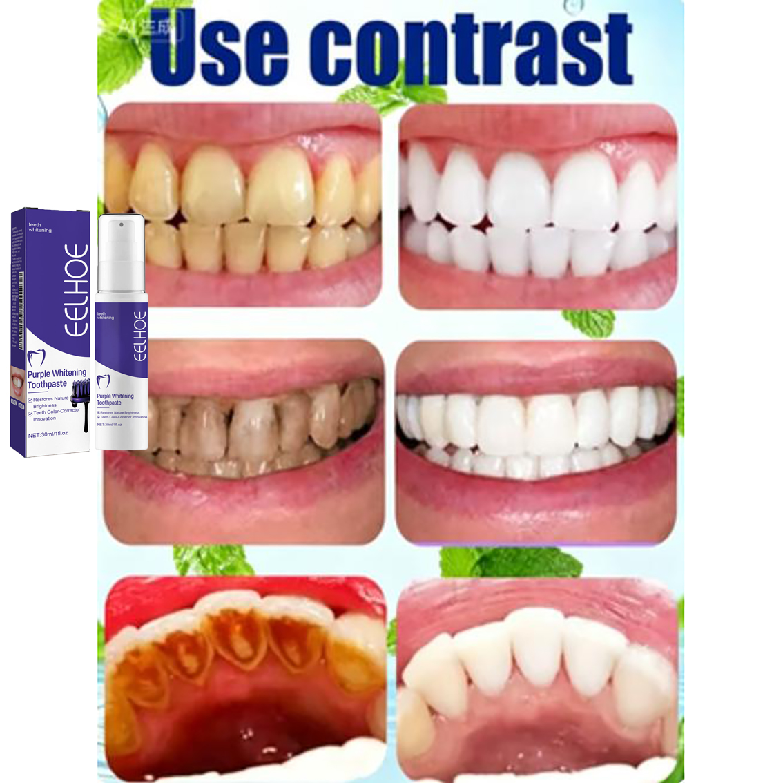 Teeth Cleansing Whitening Toot - Teeth Whitening In Korea ulasan dan harga