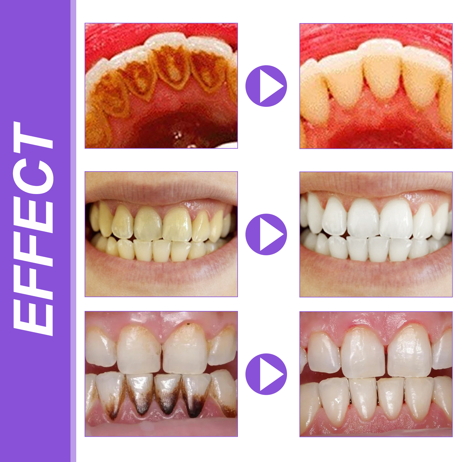 EELHOE Smiles Bright White Ref - Teeth Whitening Ingredients ulasan dan harga