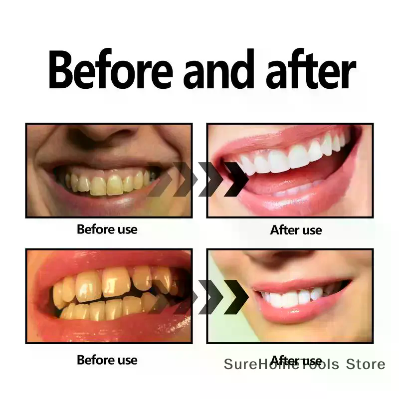 Bamboo Charcoal Powder For Tee - Teeth Whitening Ingredients ulasan dan harga
