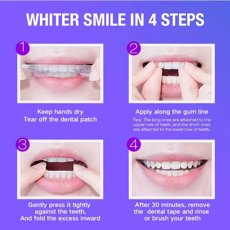 Teeth Whitening Kit - 5X LED L - Teeth Whitening Gel For Trays ulasan dan harga