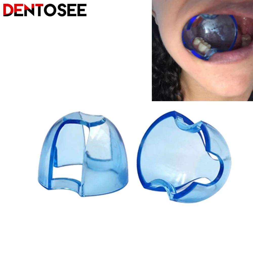 Dental Intraoral Cheek Retract - Teeth Whitening Accelerator ulasan dan harga