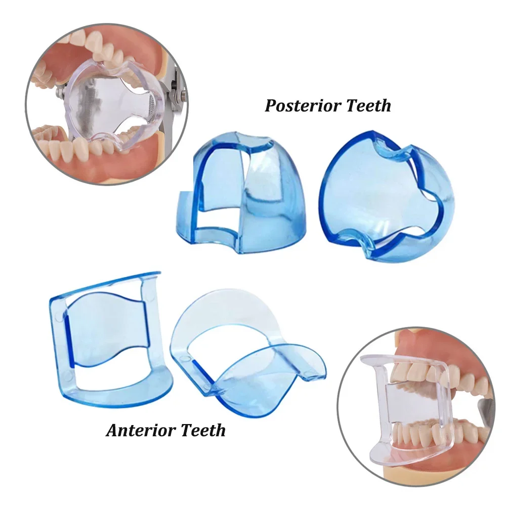 Dental Intraoral Cheek Retract - Teeth Whitening Accelerator ulasan dan harga
