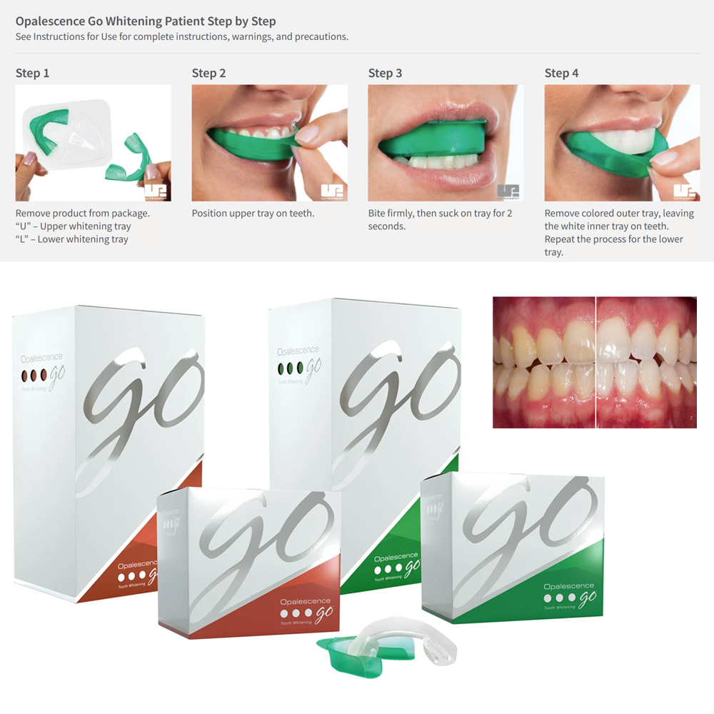 Opalescence Go Teeth Whitening - Teeth Whitening Home Kit ulasan dan harga