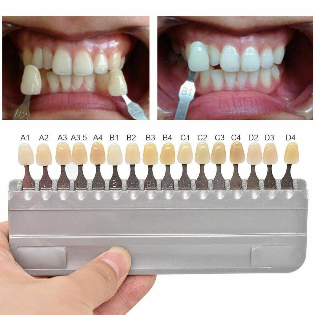 VITA 16 Colors Teeth Shade Gui - Teeth Whitening Shade Guide ulasan dan harga