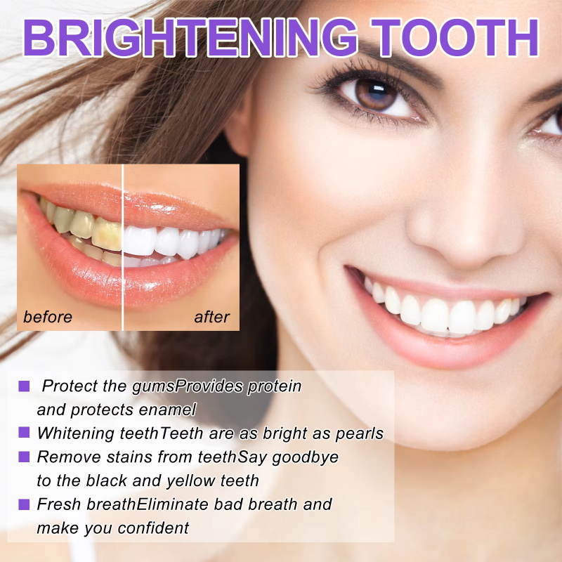 Teeth Cleansing Whitening Toot - Teeth Whitening In Korea ulasan dan harga