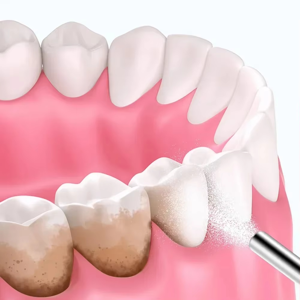 Dental Sandblasting Powder 500 - Teeth Whitening Ingredients ulasan dan harga