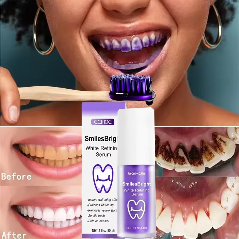 Teeth Cleansing Whitening Toot - Teeth Whitening In Korea ulasan dan harga