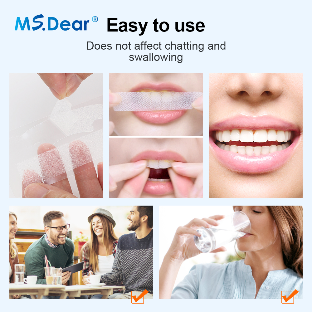 Teeth Whitening Strips Cleansi - Teeth Whitening Foam ulasan dan harga